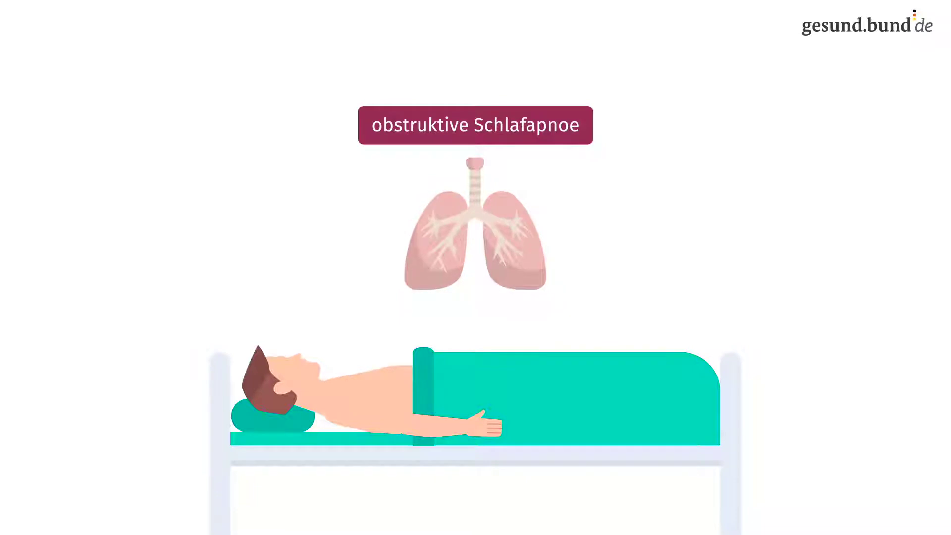 Schlafapnoe Video